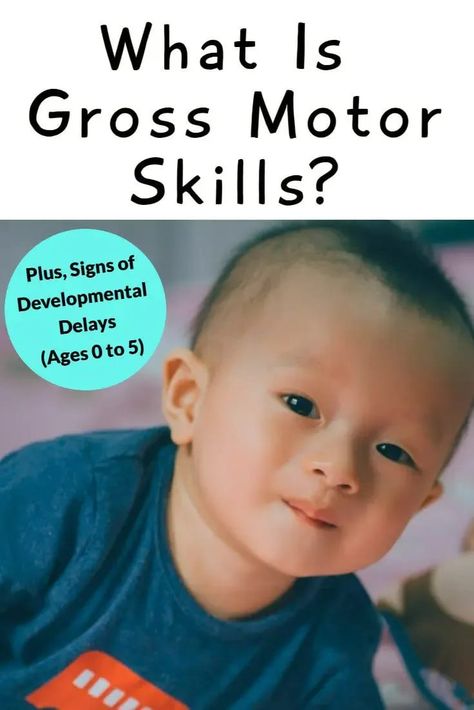 Therapy For Kids, Preschool Workbooks, Motor Development, Developmental Delays, Gross Motor Activities, Motor Skills Activities, Get Out Of Bed, Muscle Body, Special Needs Kids