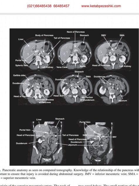 Abdominal Ct Scan, Studying For Ct Registry, Ct Abdomen Anatomy, Ct Scan Abdominal, Nuclear Medicine Technologist, Charting For Nurses, Medical Radiography, Vascular Ultrasound, Radiologic Technology