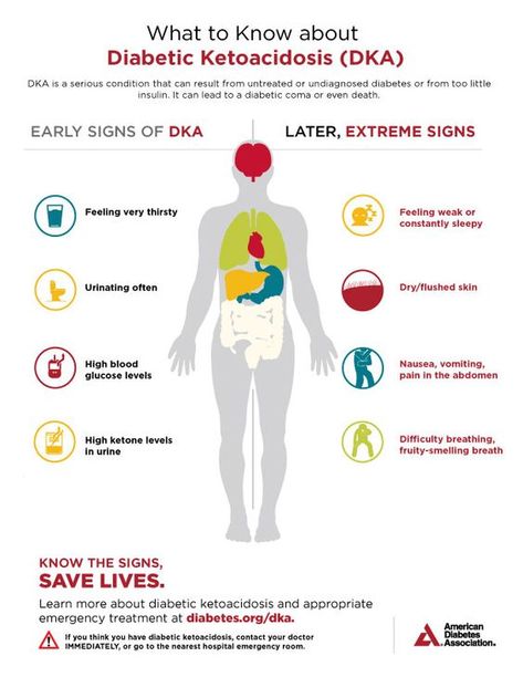 What to know about Diabetic Ketoacidosis (DKA) - Infographic Nursing Facts, Nclex Pn, Medical Training, Feeling Weak, Medical Terms, Endocrine System, Nclex, Nursing School, Fatty Acids