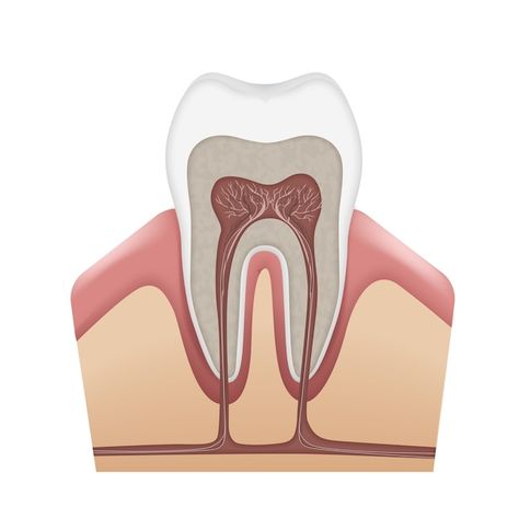 Tooth Caries, Abscess Tooth, Tooth Anatomy, Teeth Anatomy, Dental Extraction, Dental Implant Surgery, Medical Pictures, Human Teeth, Teeth Implants