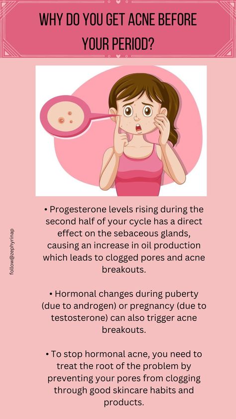 When you think of period acne, you need to understand that your period isn’t the main culprit for breakouts. Rather, your hormones should be the ones to take most of the blame. Period Acne, Health Corner, Skincare Habits, Medical School Life, Progesterone Levels, Menstrual Health, Fashion Terms, Girl Advice, Hormonal Acne