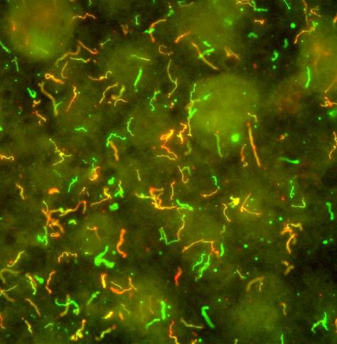 Borrelia burgdorferi spirochetes labeled green or orange depending on the expression of surface proteins, which they alter to adapt to their various hosts Bacterial Infection, Environmental Health, Microbiology, Blood Vessels, Chronic Illness, Ticks, Nervous System, Disease