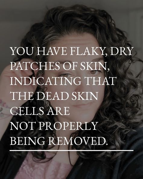 Is your skin looking dull, flaky, or breaking out more than usual? You might not be exfoliating properly! Here are 5 signs your skin needs better exfoliation: 1. Dull, rough texture 2. Clogged pores & breakouts 3. Flaky or patchy skin 4. Uneven skin tone 5. Skincare products not absorbing well Exfoliating regularly helps remove dead skin cells, revealing a smoother, brighter complexion. 🌟 Don’t skip this essential step in your routine. Use a gentle exfoliating product once or twice a ... Patchy Skin, Rough Texture, Clogged Pores, Uneven Skin, Uneven Skin Tone, Dead Skin, Skin Cells, Skin Tone, Skincare Products