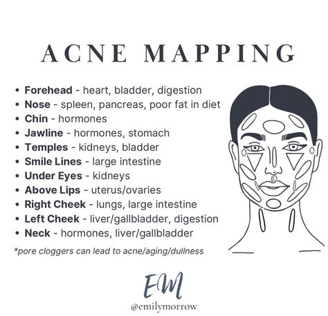 Acne Placement Meaning, Acne Chart, Acne Face Mapping, Acne Face Map, Hormone Nutrition, Causes Of Acne, Face Mapping Acne, Forehead Acne, Blood Work