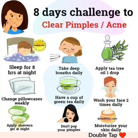 Clear Pimples, Pimple Free Skin, How To Clear Pimples, Fitness Content, Courge Spaghetti, Pimples Remedies, Natural Face Skin Care, Natural Acne Remedies, Acne Care