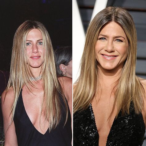 Jennifer Aniston Looks Exactly The Same 17 Years Later — How It Cost Her $1.5 Million Jennifer Aniston Nose Job, Jennifer Aniston Nose, Laser Facial, Facial Scars, 5 Million Dollars, Jennifer Aniston Style, Jennifer Aniston Hot, Too Much Makeup, Nose Job