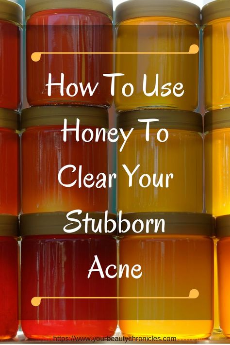 Stubborn Acne Remedies, Honey Mask For Acne, Honey For Acne, Skin Drinks, Face Care Tips, Diy Acne, Natural Acne Remedies, Natural Acne, Acne Scar