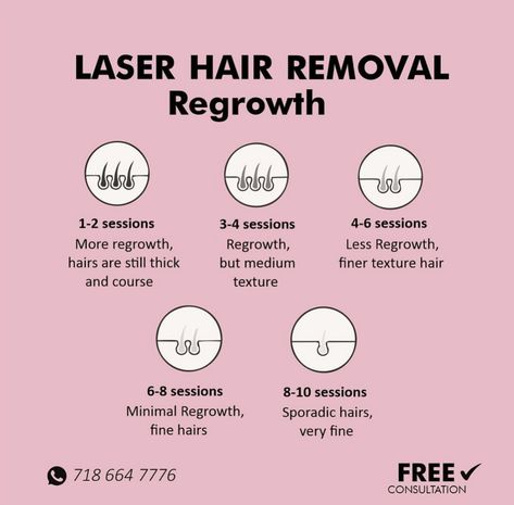 Laser Hair Removal Dos And Donts, Laser Hair Removal Advertising, Laser Removal Hair, Laser Hair Removal After Care, Laser Hair Removal Black Women, Laser Hair Removal Benefits, Laser Hair Removal Post Ideas, Laser Hair Remover, Laser Hair Removal Quotes