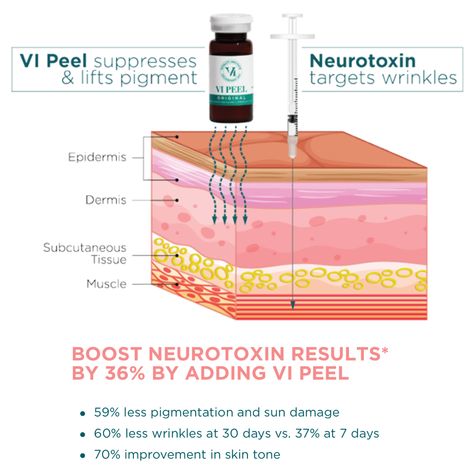 Vi Peel Before And After, Peel Season, Botox Aesthetic, Vi Peel, Skin Care Business, Subcutaneous Tissue, Work Train, Chemical Peels, Medical Aesthetics