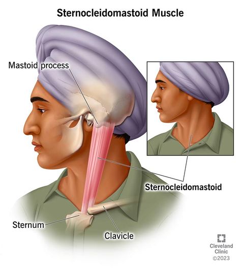 Scm Muscle, Sternocleidomastoid Muscle, Referred Pain, Neck Tattoo For Guys, Skeletal Muscle, Good Posture, Cold Therapy, Neck Pain, Regular Exercise