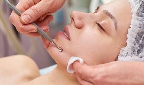 What are Facial Extractions? | Skincare.com Facial Extractions, Acne Tool, Teenage Acne, Forehead Acne, Comedone Extractor, Deep Cleansing Facial, Aesthetic Center, Get Rid Of Blackheads, Hair Removal Permanent