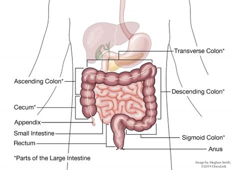 Surgical Procedures: Colectomy | OncoLink Sigmoid Colon, Ostomy Care, Large Bowel, Surgical Procedures, Types Of Surgery, Surgery Recovery, Chronic Pain, Staging, The Journey