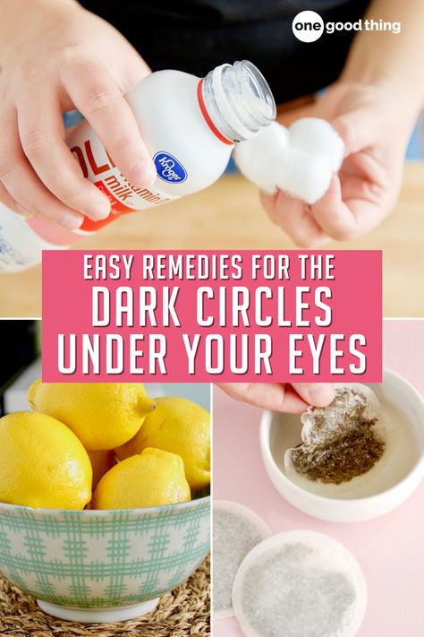 The best part about getting rid of dark circles under your eyes? Having a ready-made excuse to rest quietly on the couch for a while. Removing Dark Circles Under Eyes, How To Get Rid Of Black Circles Eye, Black Under Eye, Remedies For Dark Circles, Dark Circle Remedies, Essential Oil Beauty, Dry Skincare, Homemade Face Cream, Under Eye Puffiness