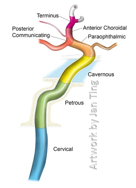 Internal Carotid Artery NYU Classification Atlas Anatomy, Nervous System Anatomy, Vascular Ultrasound, Internal Carotid Artery, Mri Brain, Diagnostic Medical Sonography, Eye Facts, Brain Surgeon, Gross Anatomy