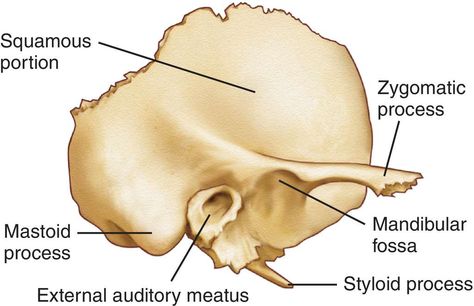 Temporal Bone, Skeletal System Anatomy, Dog Funnies, Axial Skeleton, Paranasal Sinuses, Internal Carotid Artery, Facial Bones, Medical Dictionary, Skull Anatomy