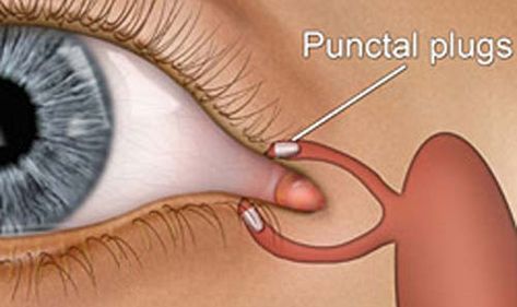 Eye Disorders, Eye Floaters, Increase Height Exercise, Dry Eye Symptoms, How To Help Nausea, Eye Facts, Eye Anatomy, Eye Twitching, Eye Tricks