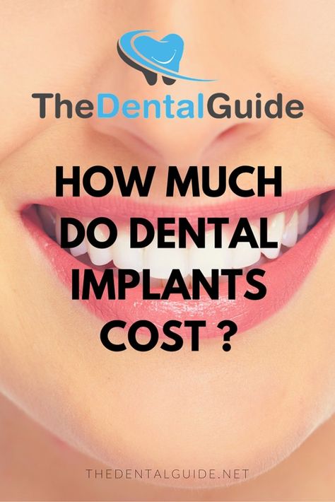 How Much Do Dental Implants Cost in the UK? - The Dental Guide Dental Bridge Cost, Dental Bonding, Best Dental Implants, Dental Implant Surgery, Dental Implants Cost, Teeth Implants, Dental Bridge, Dental Veneers, Dental Crowns