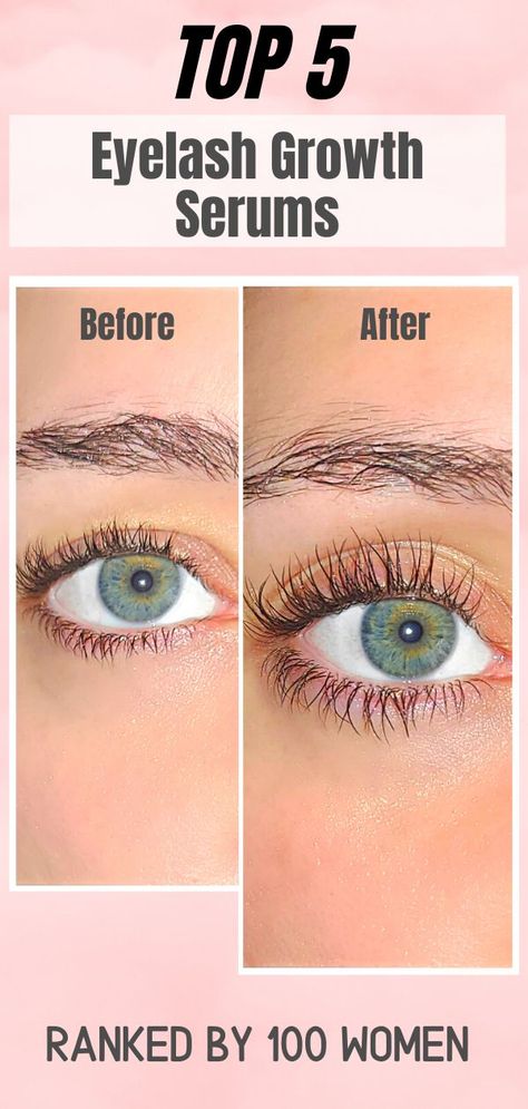 Eyelash Growth Vaseline, Eyelash Serum Diy, Latisse Eyelashes, Long Lashes Serum, Eyelash Growth Cycle, Grande Lash Serum, Eyelash Growth Diy, Eyelash Serums, Best Lash Serum