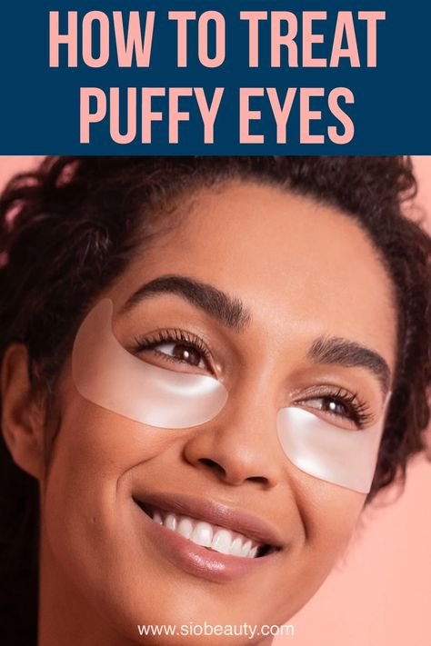 woman wearing eye patches to get rid of puffy eyes and bags How To Get Rid Of Eye Bags Fast, Puffy Under Eyes Bags, Baggy Eyes Remedy, Bags Under Eyes Remedy, Eye Bags Remedy, Undereye Bags Remedy, Puffy Under Eyes, Puffy Eyes Remedy, Baggy Eyes