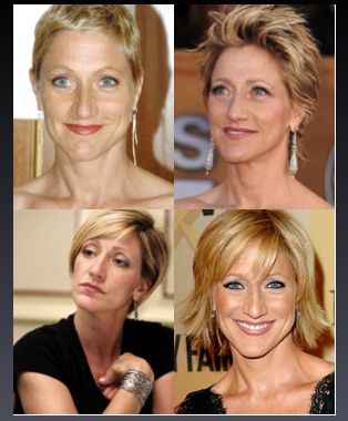 Edie Falco growing out her hair... what a process... but she made it look good! Edie Falco, Nurse Jackie, Blonde Woman, Blonde Women, Hair Envy, Made It, Her Hair, Short Hair, Short Hair Styles