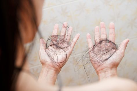 How to Handle Thinning Hair Polycystic ovary syndrome affects one in ten women of childbearing age, and impacts every individual differently. Women who have PCOS suffer from a hormonal imbalance and often have symptoms that can result in health problems. One of the symptoms of polycystic ovary syndrome that women struggle with is hair thinning, which can affect the appearance and confidence...  #PolycysticOvaries #ThinHair #syndrome #polycystic #HairThinning #hair #PCOS #HairLoss #women #healthy Hair Aloe Vera, Causes Of Hair Fall, Female Pattern Baldness, Hair Falling, Strands Of Hair, Point Acupuncture, Breaking Hair, Fue Hair Transplant, Polycystic Ovarian Syndrome