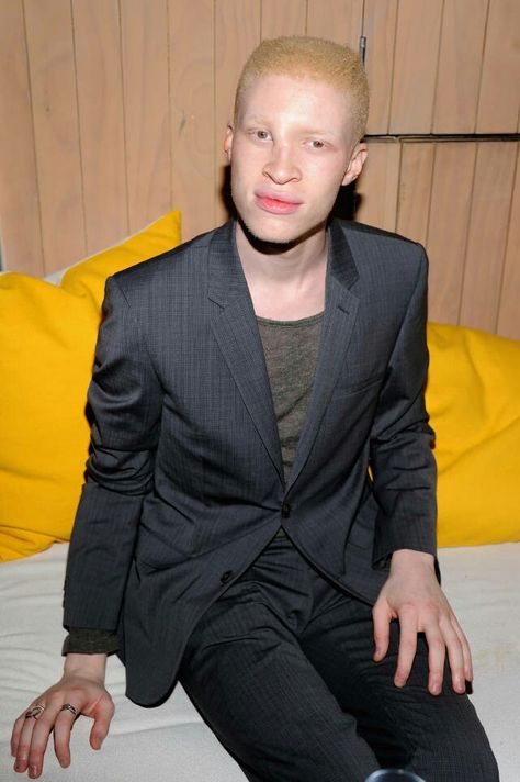 Albino Model Shaun Ross Is My Self Esteem Hero Albino Model, Shaun Ross, Stephen Thompson, Natural Hair Inspiration, Model Look, My Self, Making Waves, Model Making, Self Esteem