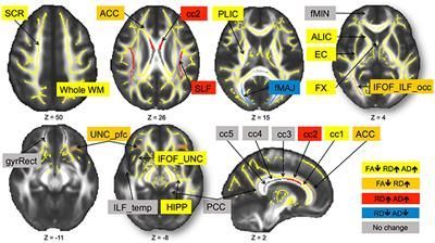 White Matter Integrity Declined Over 6-Months, but Dance Intervention Improved Integrity of the Fornix of Older Adults Cross Sectional Study, Cognitive Functions, Brisk Walking, Processing Speed, White Matter, Square Dance, Magnetic Resonance, Love Connection, Emotional Resilience