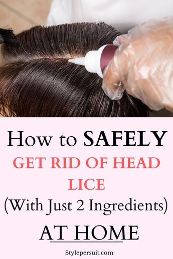 Getting rid of lice can be a challenging process, but there are several effective home remedies that you can try. Discover the methods to help eliminate lice from hair #hair #body #wellness #health #hygiene #skincare Best Way To Get Rid Of Lice And Nits, Lice Remedies How To Get Rid Of Home, How To Treat Lice At Home, How To Remove Lice Eggs From Hair, Lice Removal Home Remedies, How To Remove Lice From Hair, How To Get Rid Of Lice Fast, Lice Remedies How To Get Rid Of, How To Prevent Lice