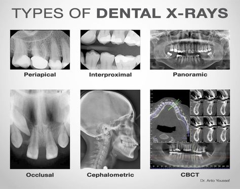 Dental Assistant Study Guide, Dental Assistant School, Dental Hygienist School, Dental Assistant Study, Dental Hygiene Student, Dental World, Kedokteran Gigi, Dental Hygiene School, Dentistry Student