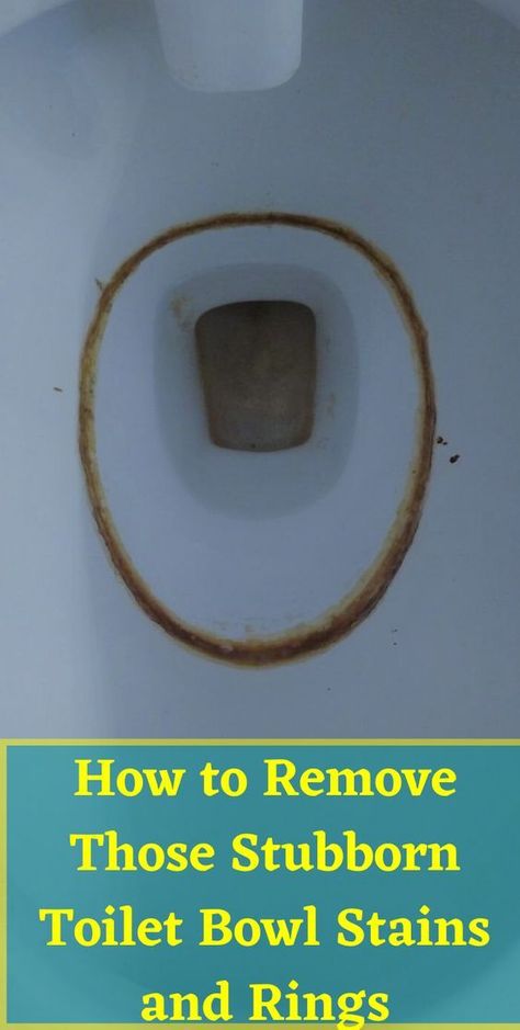 Toilet Hard Water Stains, Cleaning Toilet Ring, Clean Toilet Stains, Cleaning Toilet Stains, Clean Toilet Bowl Stains, Toilet Bowl Stains, Toilet Ring, Toilet Stains, Remove Rust Stains