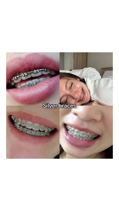 Braces On Crooked Teeth, Dark Green Braces, Grey Braces, Green Braces, Crooked Teeth, Braces, Dark Green, Grey, Green