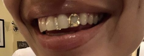 Lil Yachty Grillz, Tooth Gap Grillz, Side Tooth Grill, Grill Inspiration Teeth, Front Teeth Grillz, Gap Grillz Women, Gap Filler Grillz, Grills Women, Single Tooth Grill