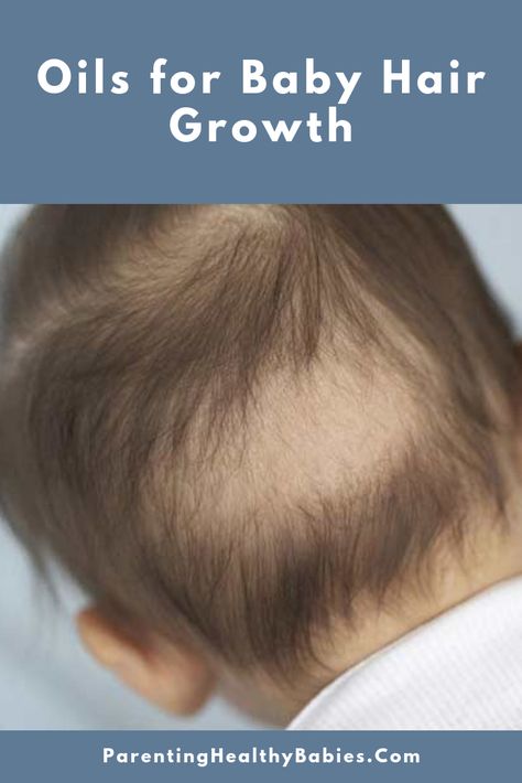 Baby Hair Growth Tips, Baby Hair Growth Remedies, Grow Baby Hair, Best Hair Oils, Hair Grow Oil, Baby Hair Growth, Faster Hair Growth, Essential Oils For Babies, Stop Hair Breakage