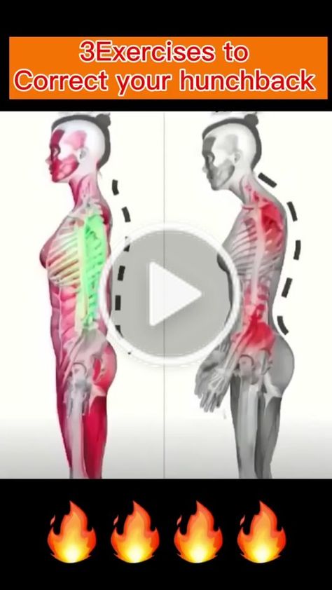 Hunchback Posture, Posture Exercises, Health Workout, Yoga Health, Fitness Workout For Women, Fitness Workout, Short Video, Workout Videos, Get Fit