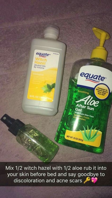 @nunbutabrat 💛 Pimple Scars, Aloe Gel, Acne Scar Removal, How To Get Rid Of Acne, New Energy, Health And Beauty Tips, Facial Care, Up Girl, Skin Treatments