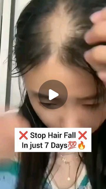 Hair Fall Remedy Home, Hair Regrowth Tips, Bald Hair Growth, Diy Hair Growth Oil, Hair Fall Remedy, Homemade Hair Treatments, Arijit Singh, Hair Remedies For Growth, Homemade Hair Products