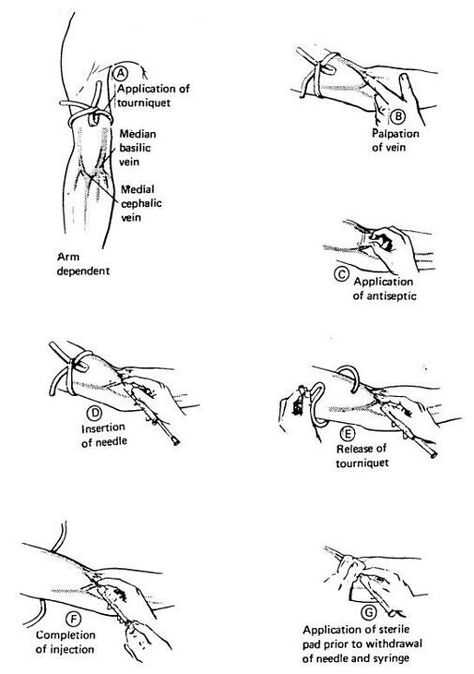 Phlebotomy Study, Medical Assistant Student, Paramedic School, Nursing School Essential, Medical School Life, Nursing School Motivation, Nurse Study Notes, Nursing Student Tips, Med School Motivation