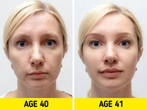 10+ Reddit Users Explain How They Would Redesign the Human Body, and They Have Some Witty Ideas Botox Training, Botox Face, Lip Wrinkles, Dermal Fillers, Vitamin C Serum, Skin Issues, Vitamin B, Skin Conditions, Facial Care