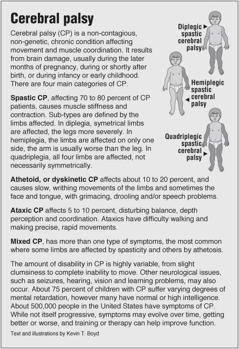 Information graphic about types of Cerebral palsy with links to acupressure for related symptoms Aba Terminology, Pediatric Neurology, Future Surgeon, Life Skills Class, Occupational Therapy Assistant, Human Body Unit, Pediatric Physical Therapy, Pediatric Occupational Therapy, Nursing School Studying