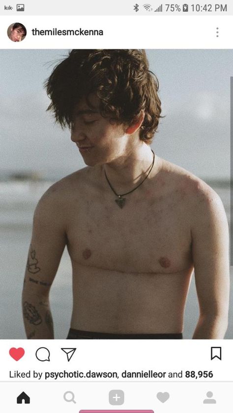 He’s daddy af Nonbinary Top Surgery, Top Surgery Results, Top Surgery Ftm, Top Surgery Scars, Miles Chronicles, Acne Positivity, Miles Mckenna, Trans Masc, Top Surgery