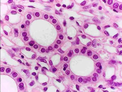 Simple cuboidal epithelia contain single layered, square shaped cells with larger volume than squamous cells. This is good for storing organelles and aids in secretions and absorption, and a production of mucus coat. This epithelia can be found in the liver, thyroid, mammary, salivary and other glands. Kidney Nephron, Tissue Drawing, Epithelial Tissue, Stratified Squamous Epithelium, Loop Of Henle, Microscopic Cells, Study Exam, Histology Slides, Basement Membrane