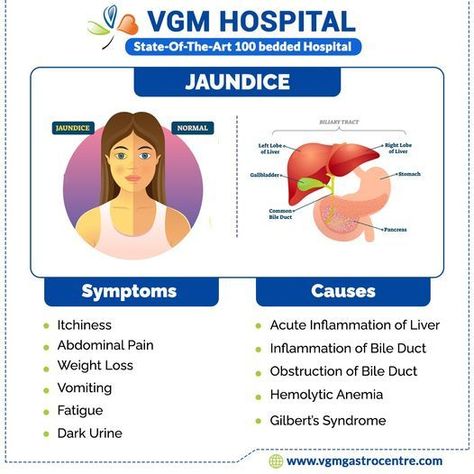 Jaundice indicates a problem with the liver or bile ducts, which can develop in people of all ages due to underlying conditions. Never ignore the signs and signals of jaundice. Read on to know the causes and symptoms of jaundice and get it treated at the earliest. #VGM #VGMHospital #VGMGastroCenter #GastroCenterinCoimbatore #BestGastroCenterinCoimbatore #GastroCenter #BestGastroCenter #JaundiceCausesandSymptoms #BestHospitalForJaundiceTreatment #JaundiceTreatment Jaundice Symptoms, Gilbert's Syndrome, New Grad Nurse, Nurse Study Notes, Bile Duct, Nursing Study, Nursing Notes, The Liver, Abdominal Pain