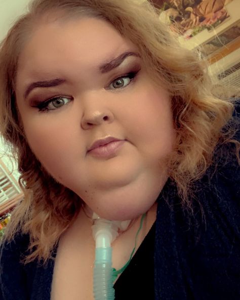 Morbidly Obese Women, Tammy And Amy, Tammy Slaton, Kate Gosselin, Chubby Face, Step Siblings, Health Disease, Biological Father, Body Measurement