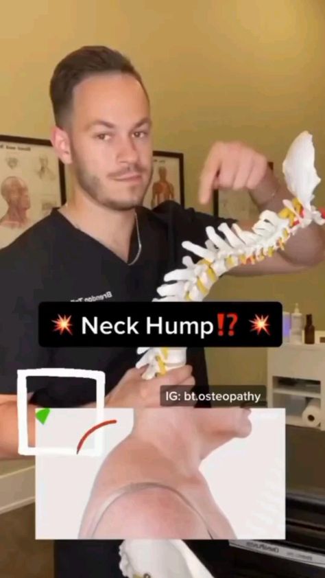 💥👉Neck exercises can help you to release tension, tightness, and stiffness. 
 • They can reduce pain and increase flexibility.
 • 👉A strong neck can help to prevent neck and cervical spine injuries as well. Exercise For Straight Neck, Cervical Lordosis Neck Exercises, Neck Injury Exercises, Neck Straightening Exercises, How To Release Tension In Neck, Straight Spine Exercises, Straight Neck Exercise, Strong Neck Exercises, Neck Elongation Exercise