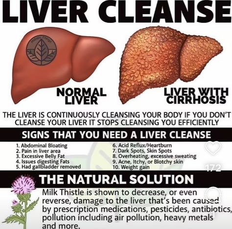 Liver Diet, Instagram Link In Bio, Health And Vitality, Home Health Remedies, Herbs For Health, Healthy Liver, Milk Thistle, The Liver, Liver Health