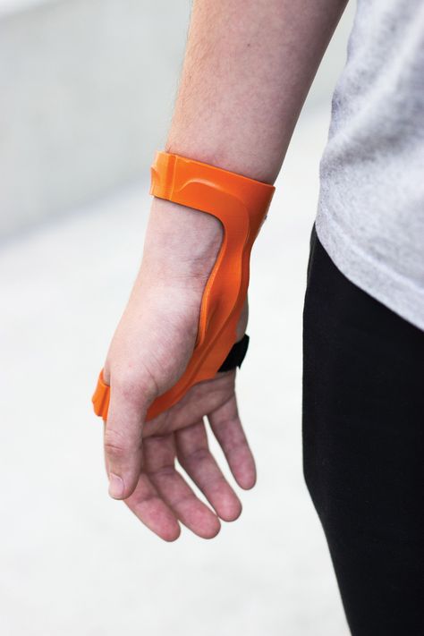 3D Platform Case Study: Researchers Developing 3D Printed Orthotics at Gonzaga University | 3DPrint.com | The Voice of 3D Printing / Additive Manufacturing Orthotics And Prosthetics, Gonzaga University, 3d Printing Industry, 3d Printer Designs, Wrist Brace, 3d Printing Diy, Wearables Design, Additive Manufacturing, Industrial Design Sketch