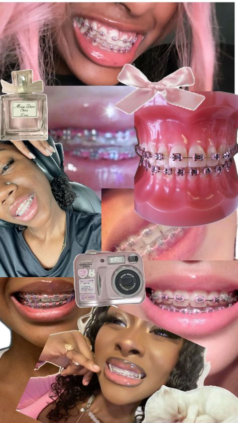 Pink Braces, Red Braces, Cute Braces Colors, Pretty Teeth, Braces Tips, Getting Braces, Cute Braces, Brace Face, Braces Colors