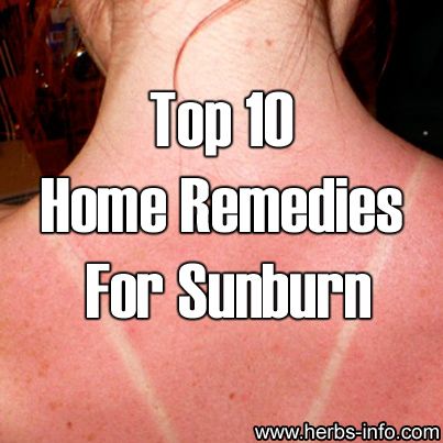 Herbs Health & Happiness Top 10 Home Remedies For Sunburn - Herbs Health & Happiness Severe Sunburn, Home Remedies For Sunburn, Sunburn Remedies, Top 10 Home Remedies, Calendula Oil, Marshmallow Root, Home Health Remedies, Tooth Decay, Skin Healing