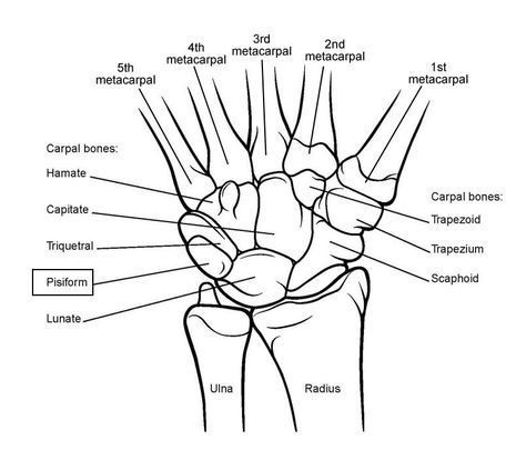 Easy to understand picture of how wrist bones sit between our two forearm bones ad the bones of our palm Human Anatomy Bones, Female Human Anatomy, Human Anatomy Organs, Hand Bone Anatomy, Anatomy Woman, Wrist Anatomy, Forearm Bones, Bones Human, Carpal Tunnel Surgery