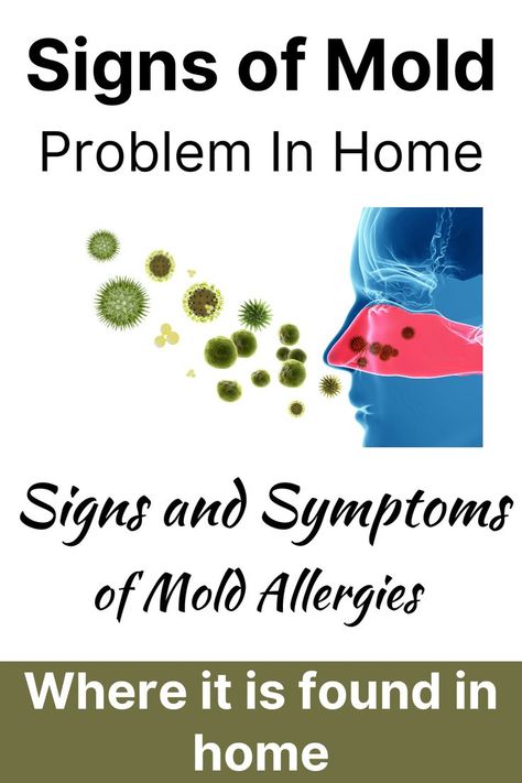 signs of mold allergy in home Mold Allergy, The Immune System, Home A, Immune System, Allergies, Healing, Signs